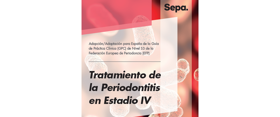 Tratamiento de la Periodontitis en Estadio IV