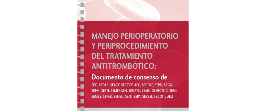 Consenso manejo antitrombótico